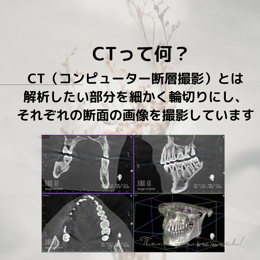 CTについて