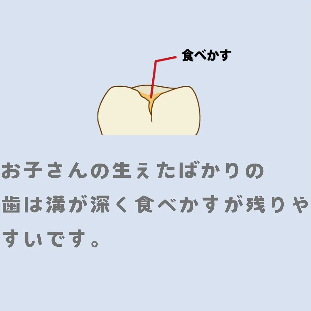 シーラントについて