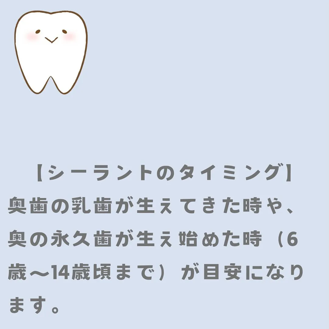 シーラントについて