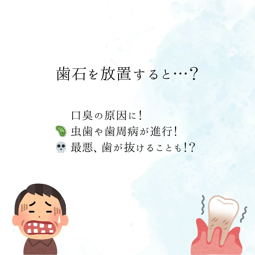 歯石取りの重要性について🌟🎶