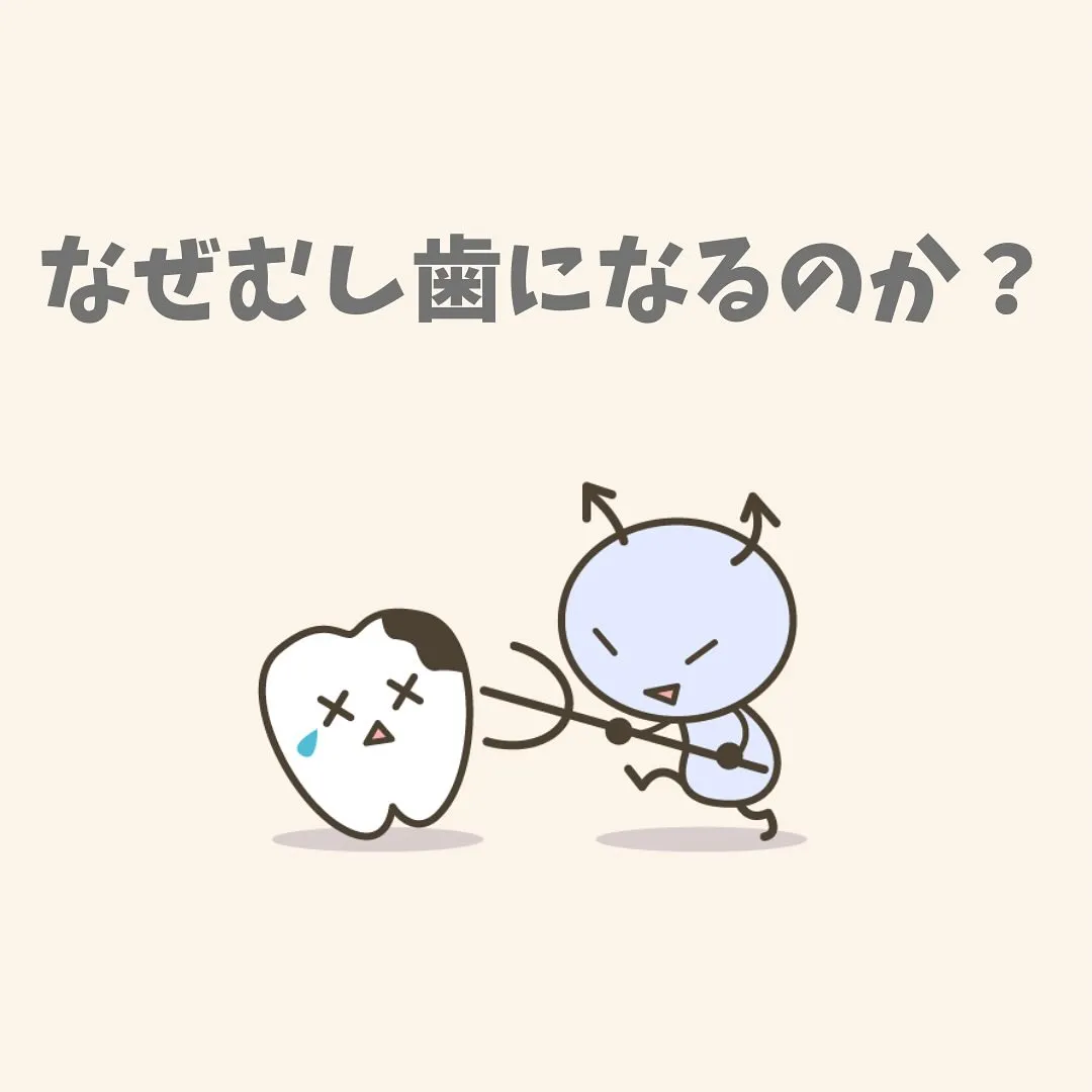 なぜ、むし歯になるのか？