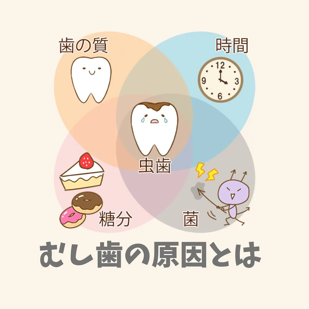 なぜ、むし歯になるのか？