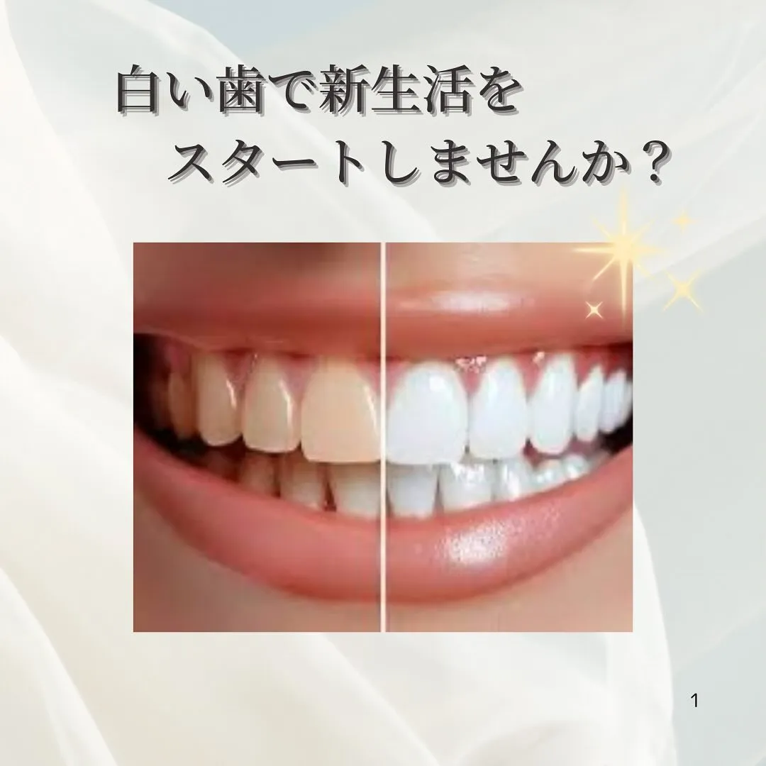 ホワイトニングについて🦷