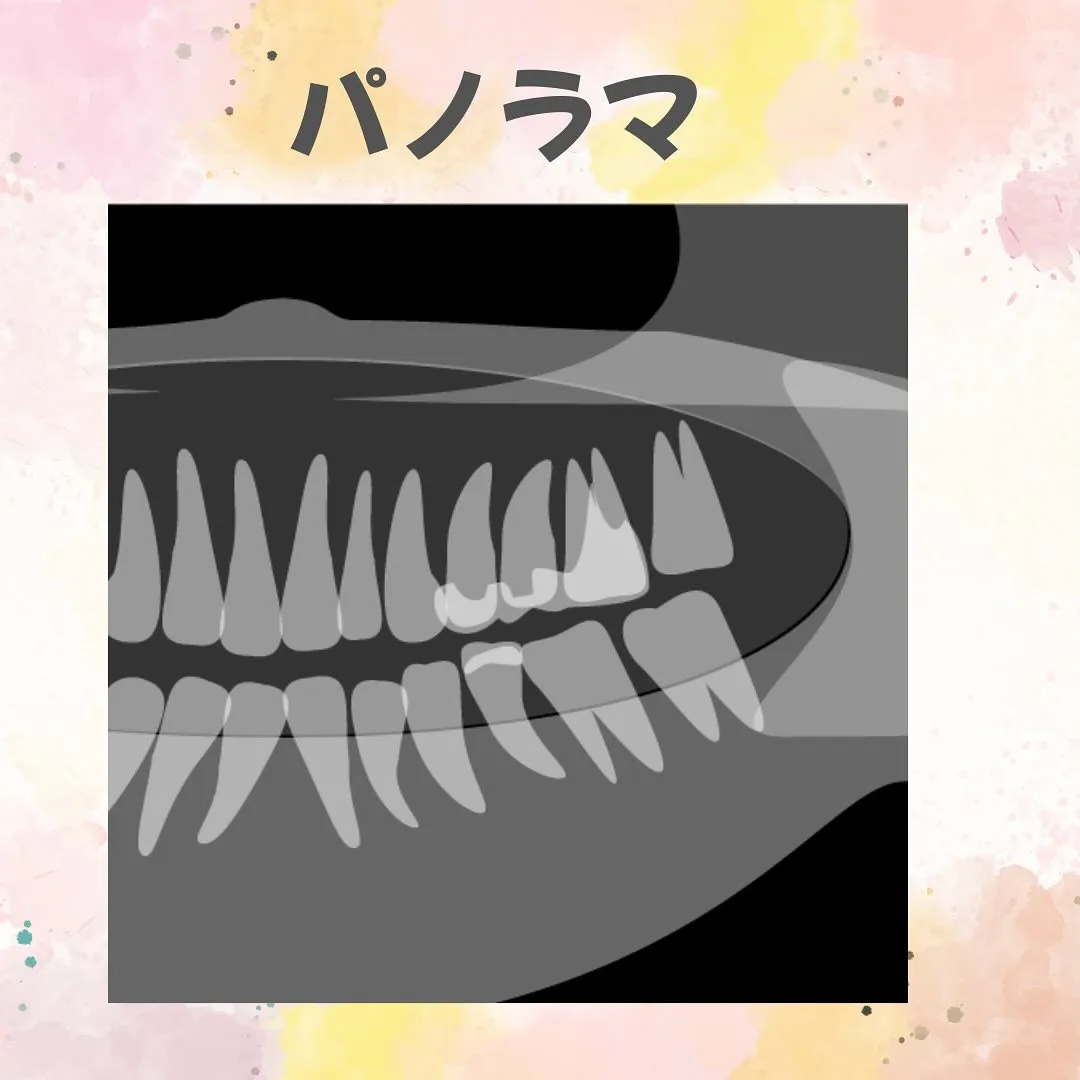 こんばんはみらい歯科・矯正歯科の中野です。