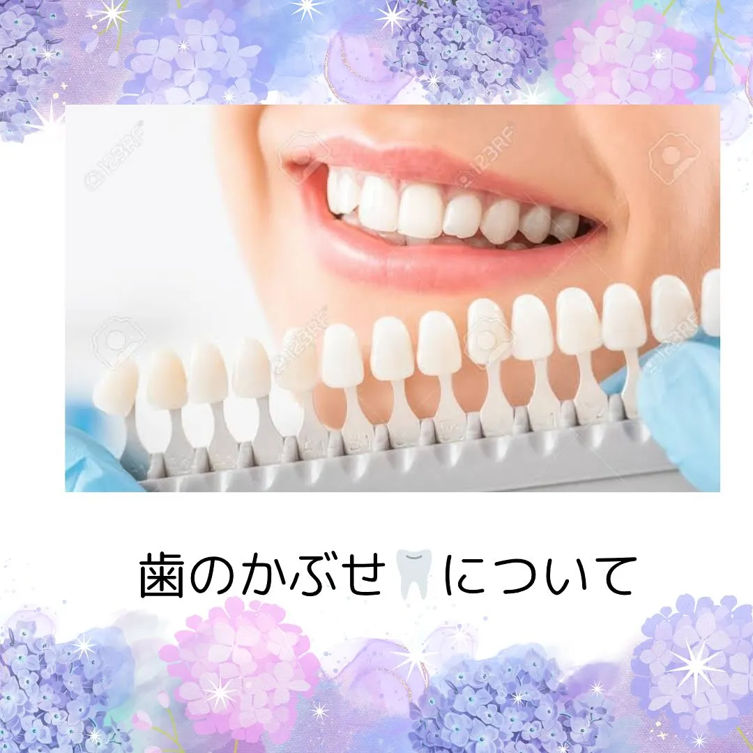 歯のかぶせものについて