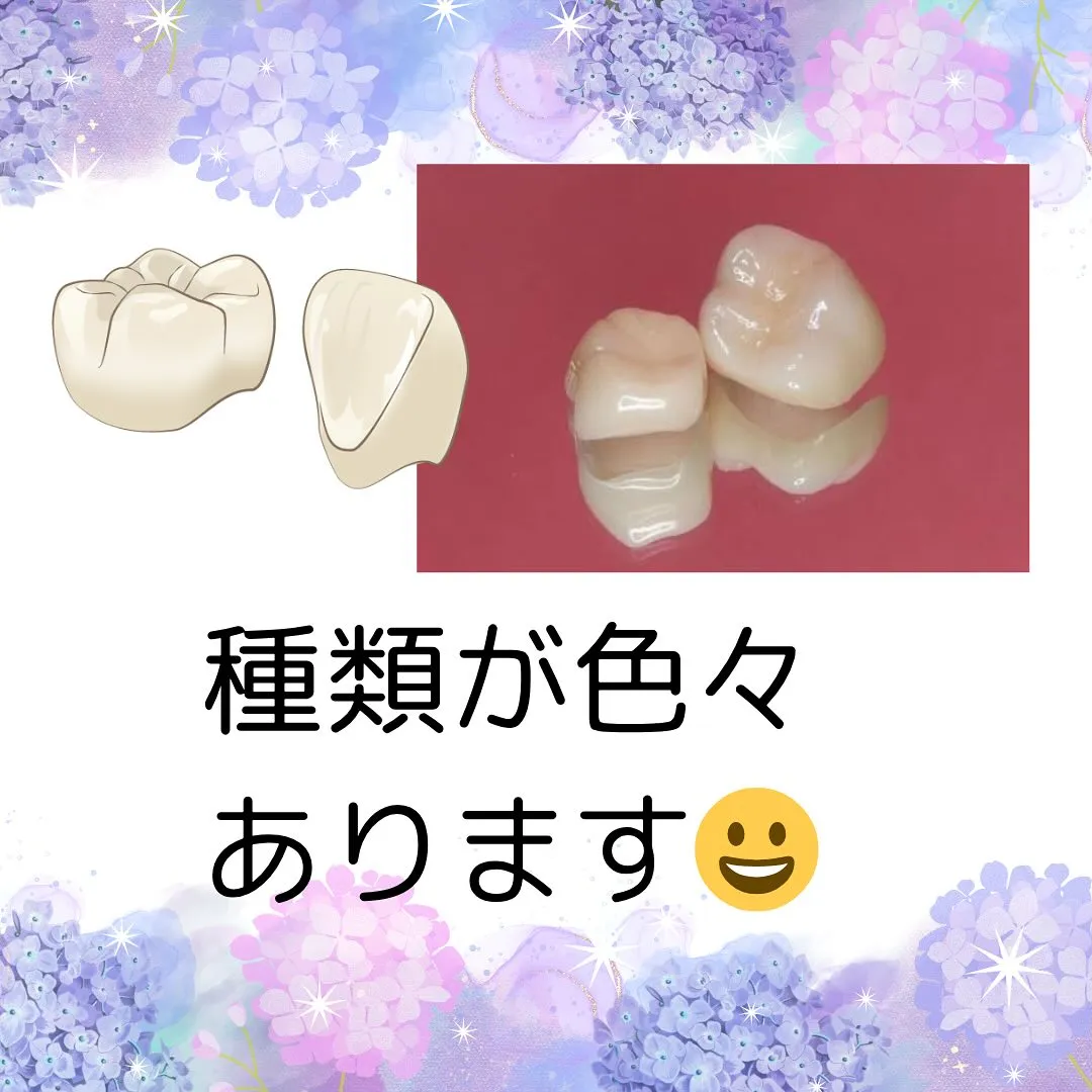 歯のかぶせものについて