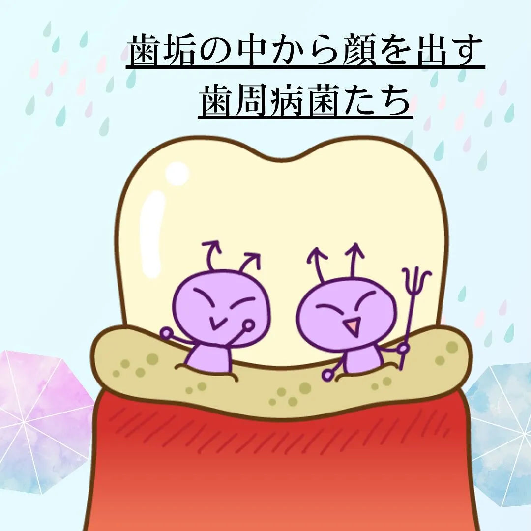 歯周病について