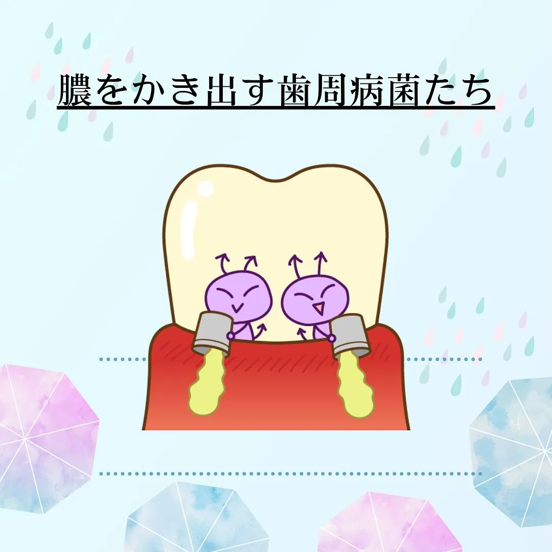 歯周病について