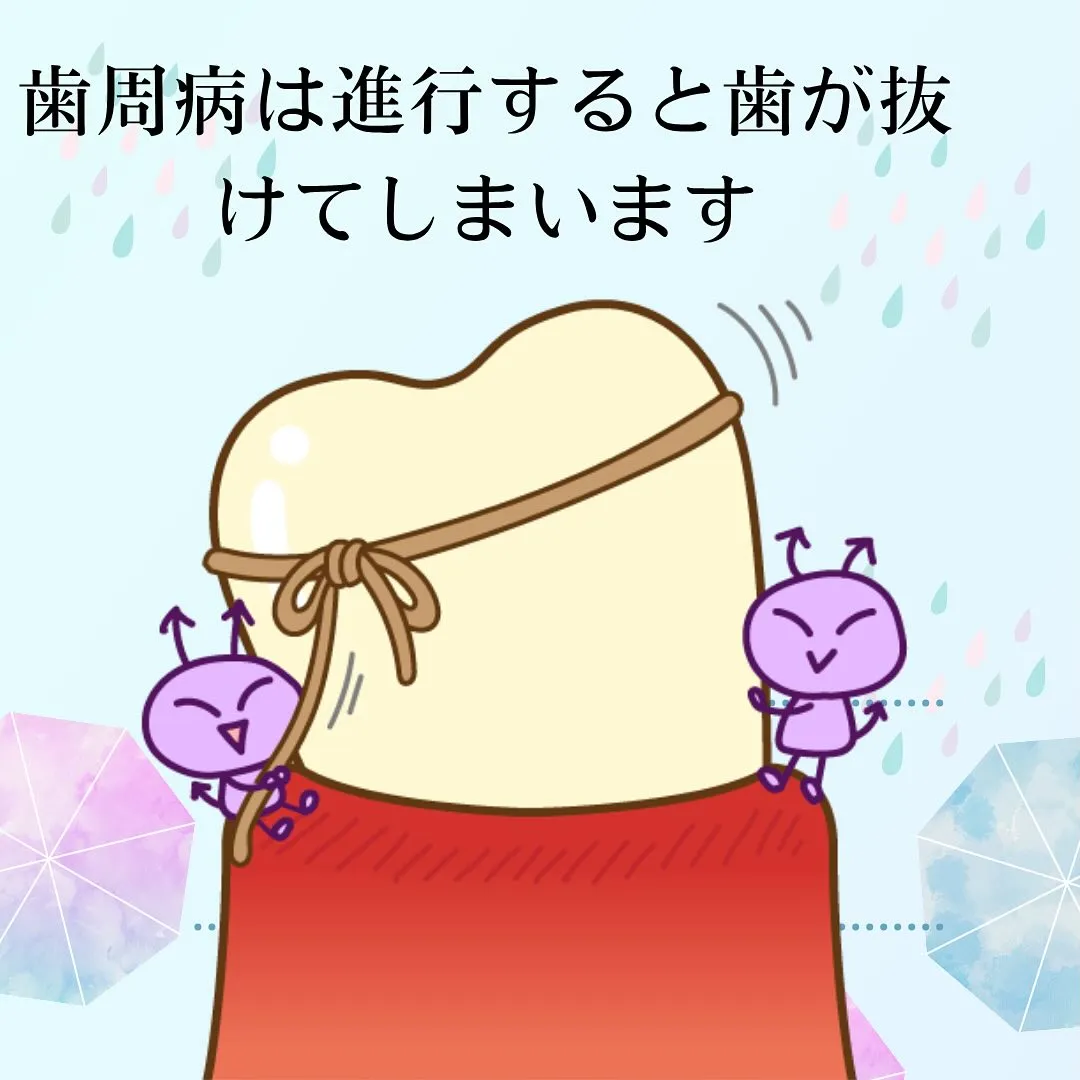 歯周病について
