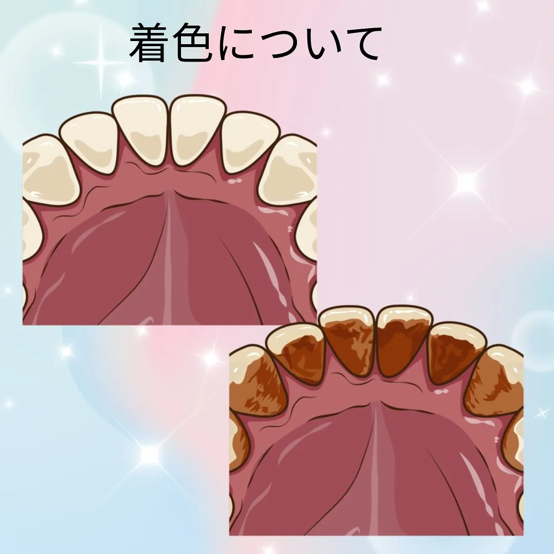 着色について