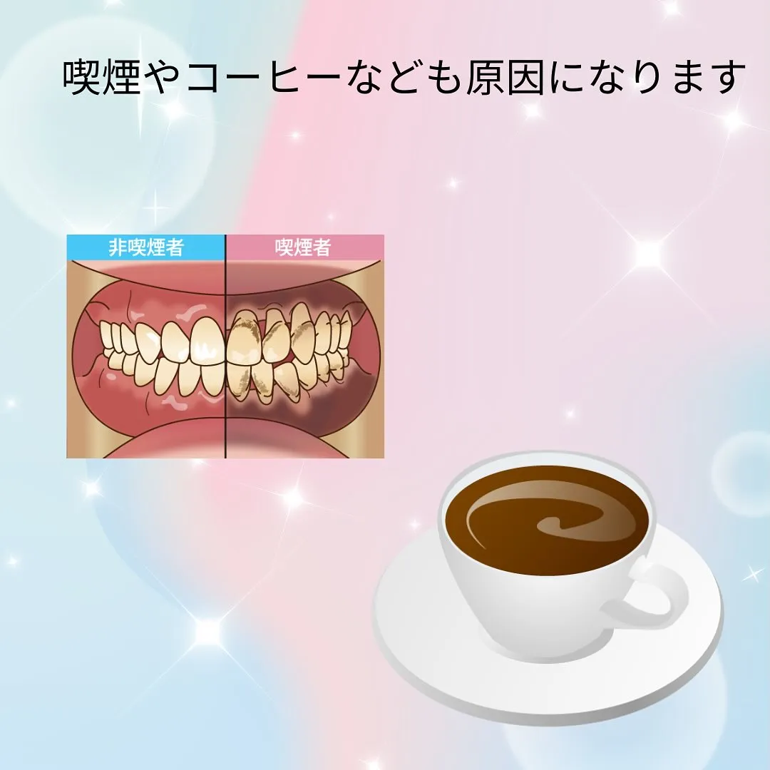 着色について