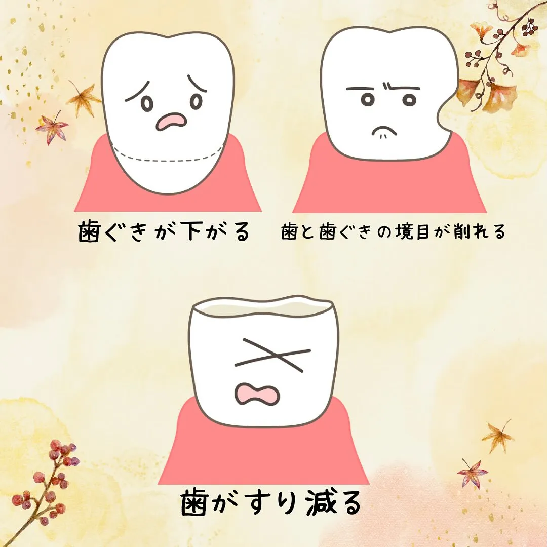 知覚過敏について