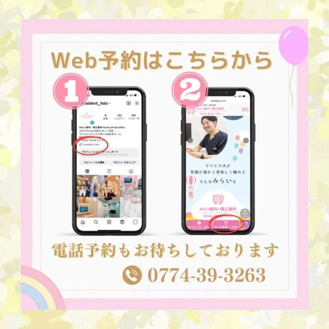 マウスピース矯正とは?