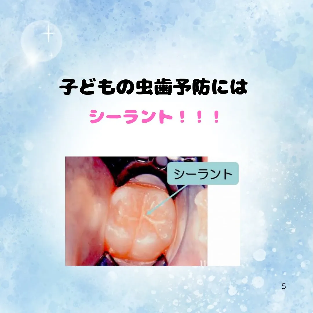 シーラントって？？？