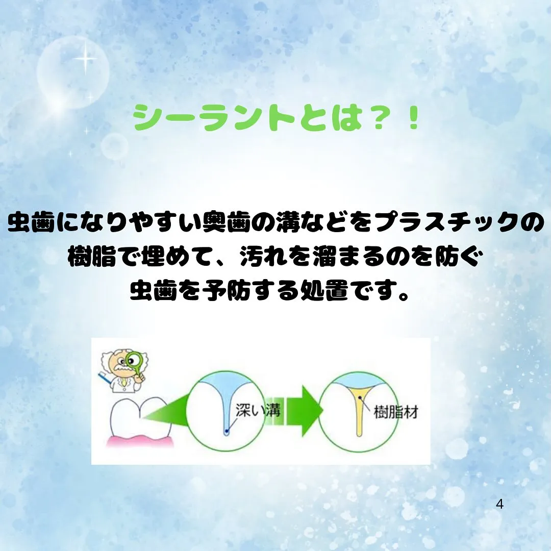 シーラントって???