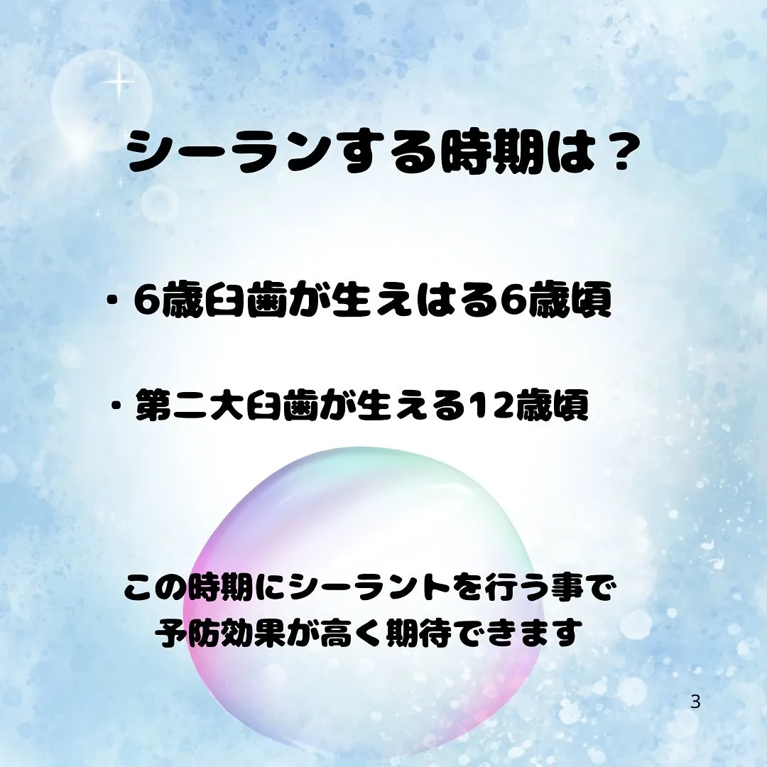 シーラントって???
