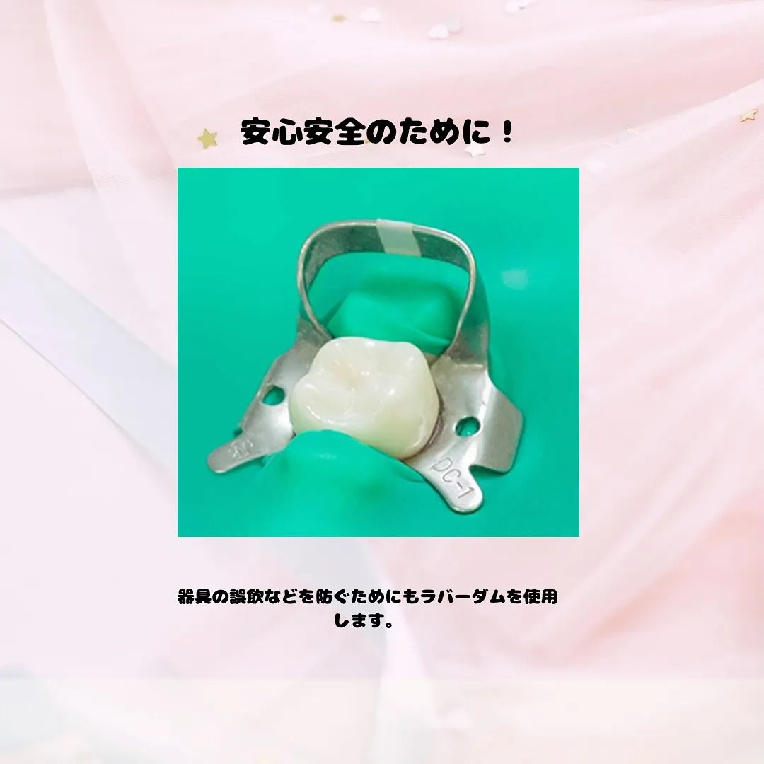 ラバーダム防湿って??