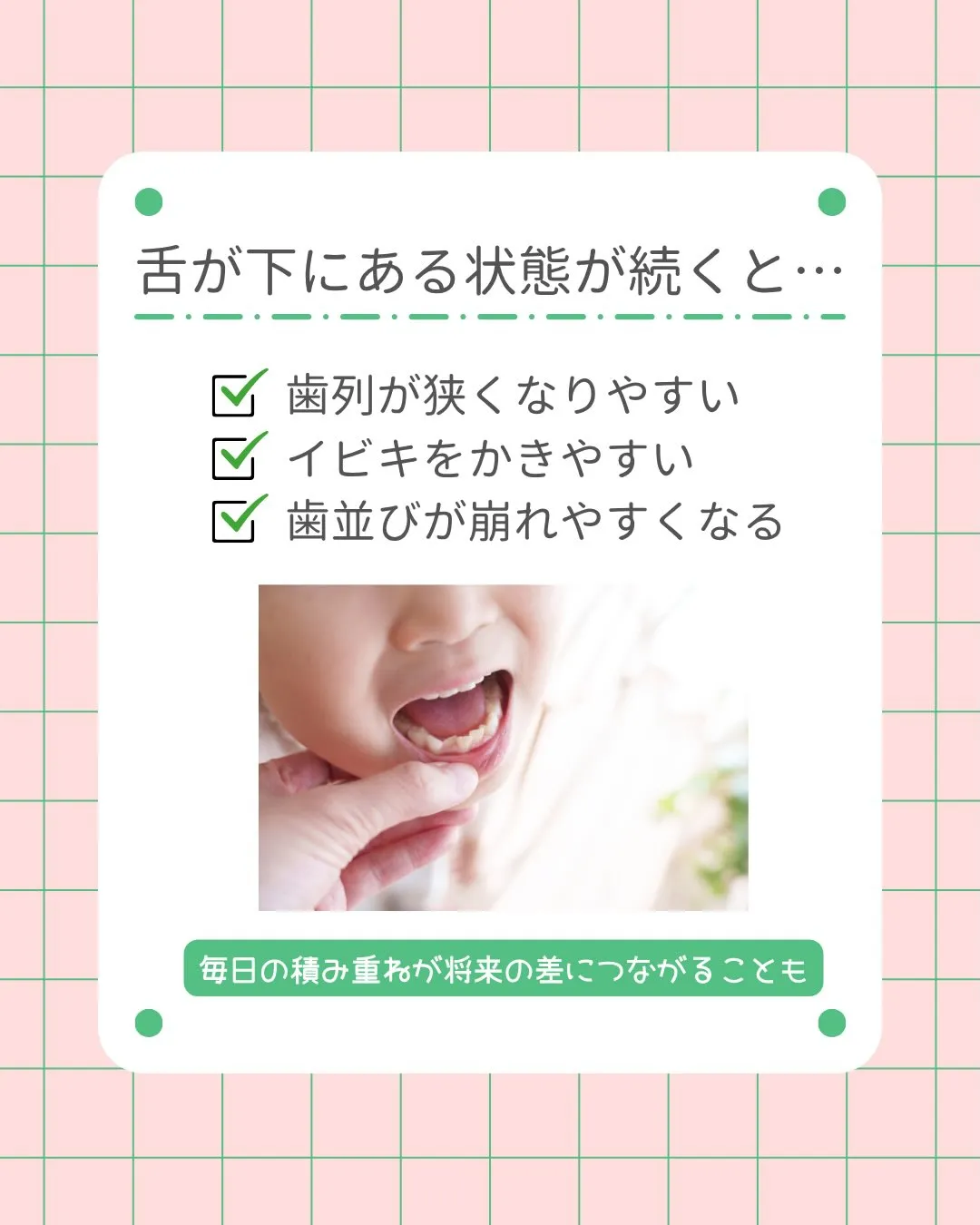 👅お子さんの「舌の位置」、気にしたことありますか？