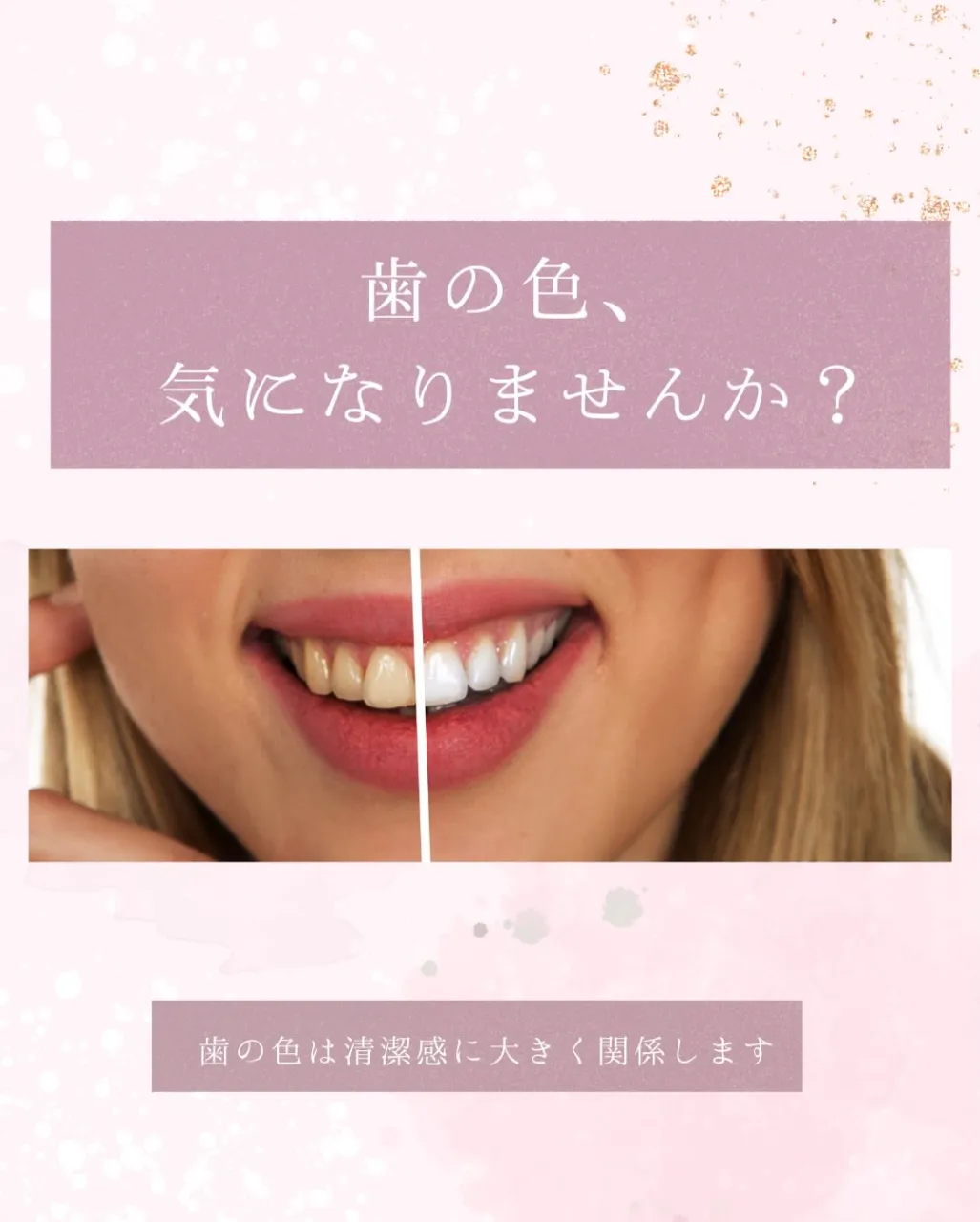 歯の色が気になることはありますか？
