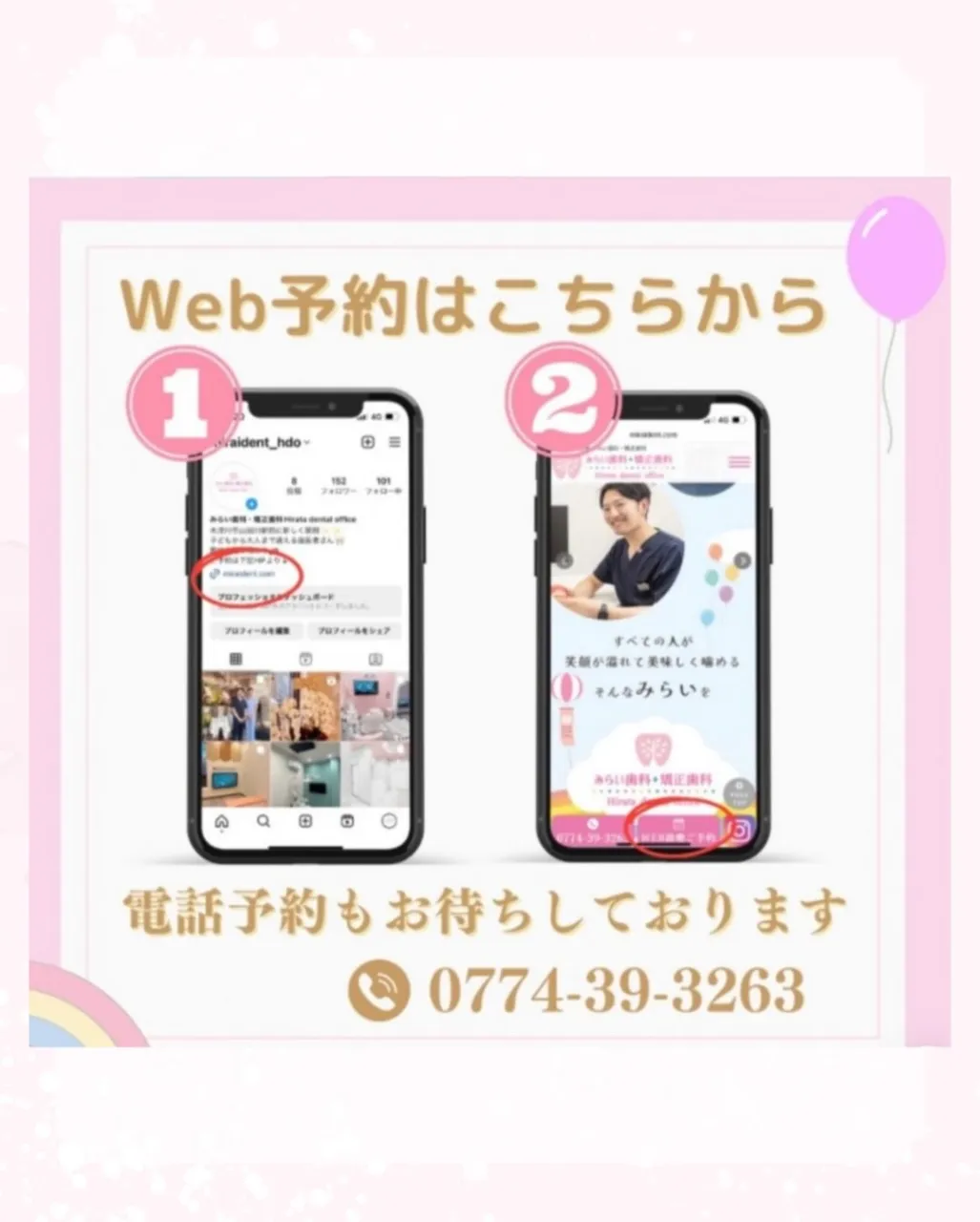 歯の色が気になることはありますか？